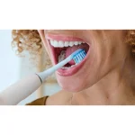 Philips Sonicare Ανταλλακτικές Κεφαλές για Ηλεκτρική Οδοντόβουρτσα HX9045/87 5τμχ - Image 2