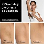 Braun Αποτριχωτική Μηχανή Epilator για Πρόσωπο, Σώμα & Μπικίνι PL5351 53881494 - Image 8
