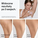 Braun Αποτριχωτική Μηχανή IPL για Πρόσωπο, Σώμα & Μπικίνι PL1100 399956 - Image 2
